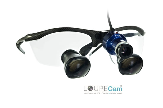 Loupecam Hd Cameras For Loupes Headlights